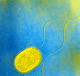 Salmonella Typhimurium (Food Poisoning)