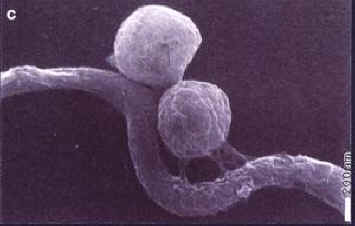 Borrelia burgdorferi spherical bodies induced by penicillin after 48h of incubation (MKP-medium, 33C): two spherical bodies adhering with a slight connection in the coil of a Borrelia organism. From "Formation and Cultivation of Borrelia burgdorferi Spheroplast-L-Form Variants." Infection 24(3):218-225, 1996. 