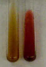 VP-negative (left) and VP-positive (right) reactions