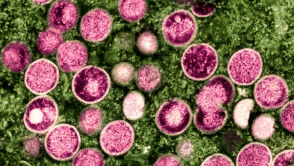 Mpox: WHO Renames Monkeypox Citing Racial Stigma - The New York Times