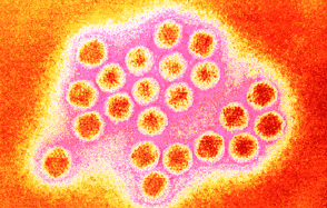 Rhinovirus