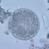 Balantidium coli cyst
