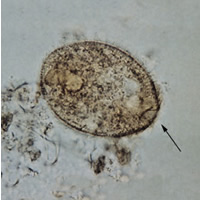 Balantidium coli trophozoite